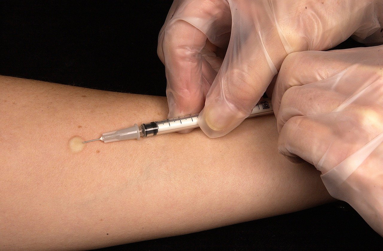 erfahren sie alles über tuberkulose, eine ansteckende erkrankung, die hauptsächlich die lungen betrifft. informationen zu symptomen, diagnose, behandlung und prävention sind hier verfügbar.